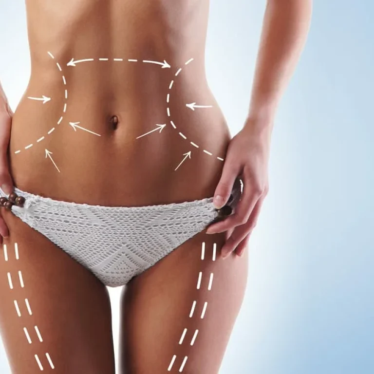 tratamiento corporal